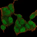 Atlas Antibodies Anti-NSD1 Antibody