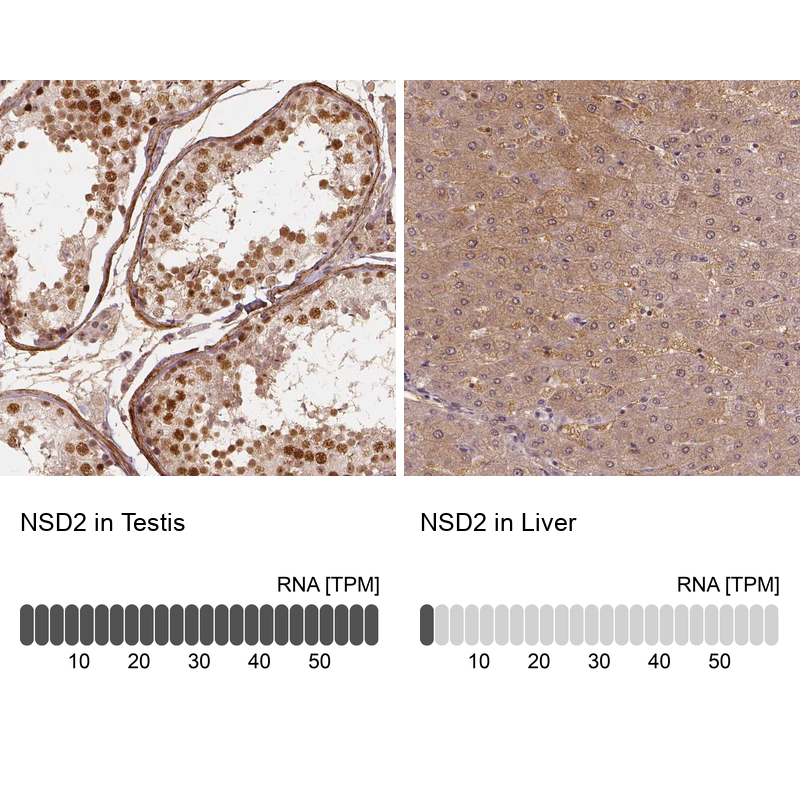 Atlas Antibodies Anti-NSD2 Antibody