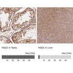Atlas Antibodies Anti-NSD2 Antibody
