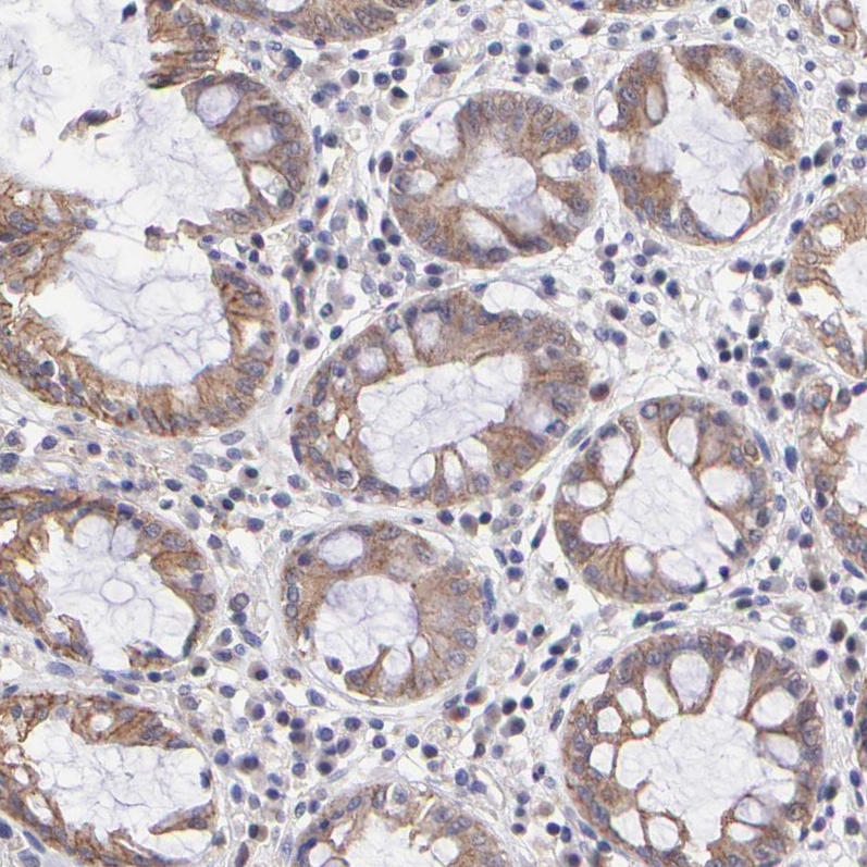 Atlas Antibodies Anti-NSF Antibody