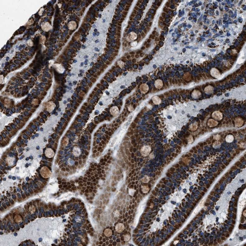 Atlas Antibodies Anti-NSD3 Antibody
