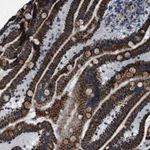 Atlas Antibodies Anti-NSD3 Antibody