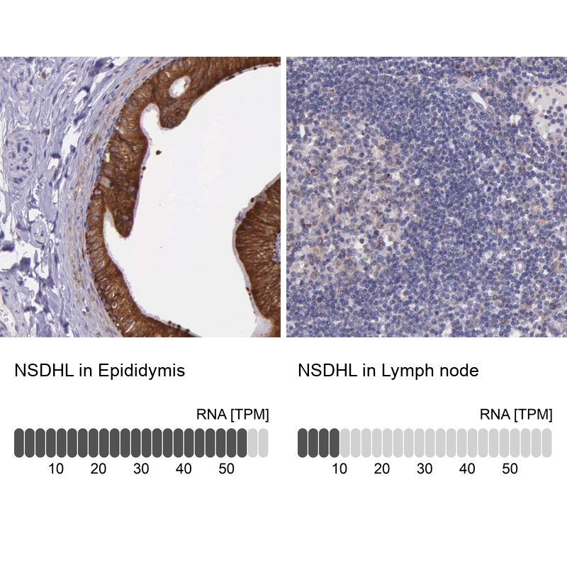 Atlas Antibodies Anti-NSDHL Antibody