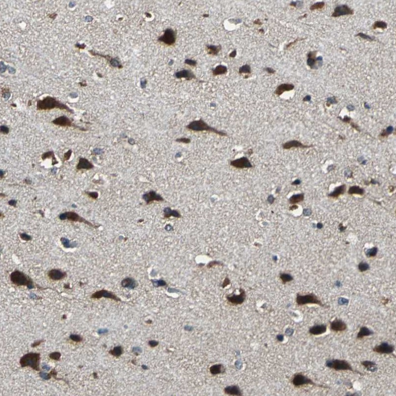 Atlas Antibodies Anti-NSD3 Antibody