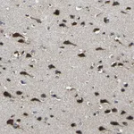 Atlas Antibodies Anti-NSD3 Antibody