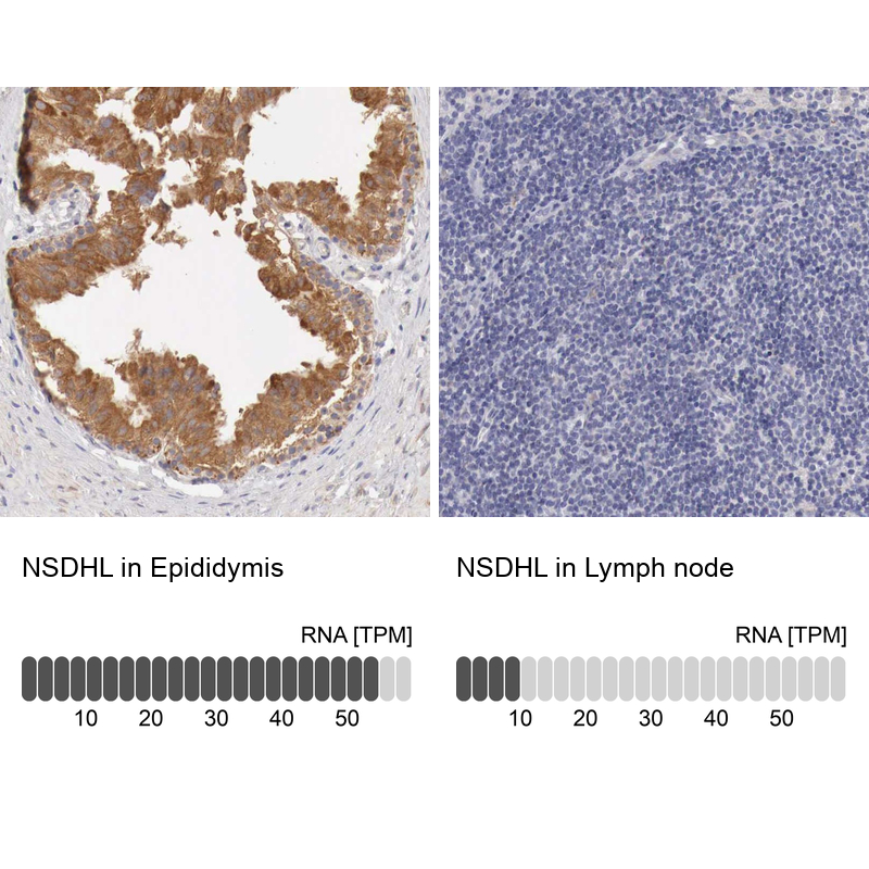 Atlas Antibodies Anti-NSDHL Antibody