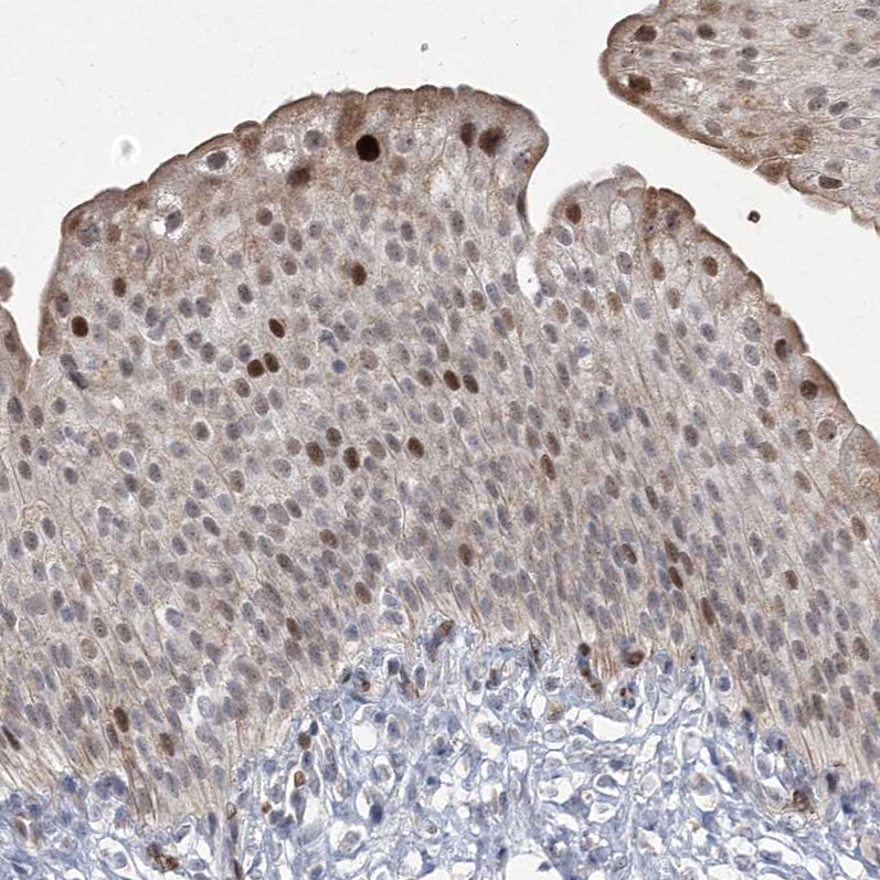Atlas Antibodies Anti-NSMCE4A Antibody