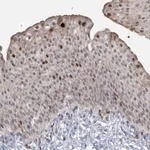 Atlas Antibodies Anti-NSMCE4A Antibody