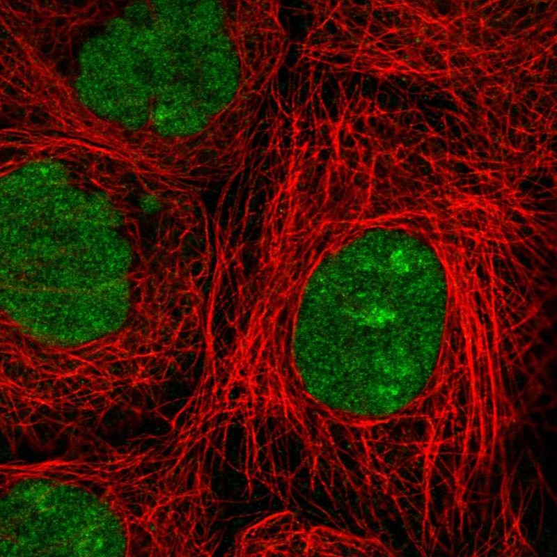 Atlas Antibodies Anti-NSMCE2 Antibody