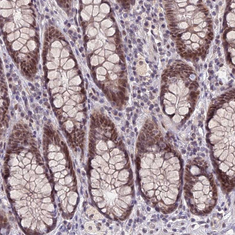 Atlas Antibodies Anti-NSMCE1 Antibody