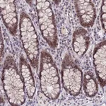 Atlas Antibodies Anti-NSMCE1 Antibody