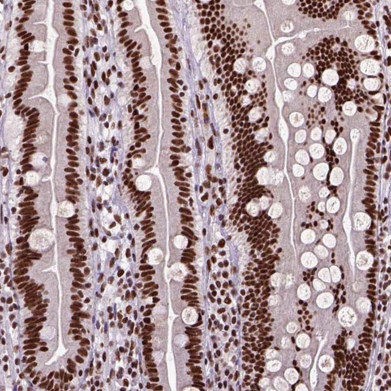Atlas Antibodies Anti-NSMCE2 Antibody