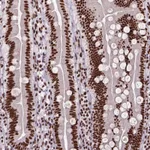 Atlas Antibodies Anti-NSMCE2 Antibody