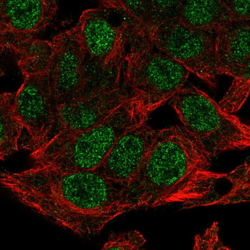 Atlas Antibodies Anti-NSMCE4A Antibody