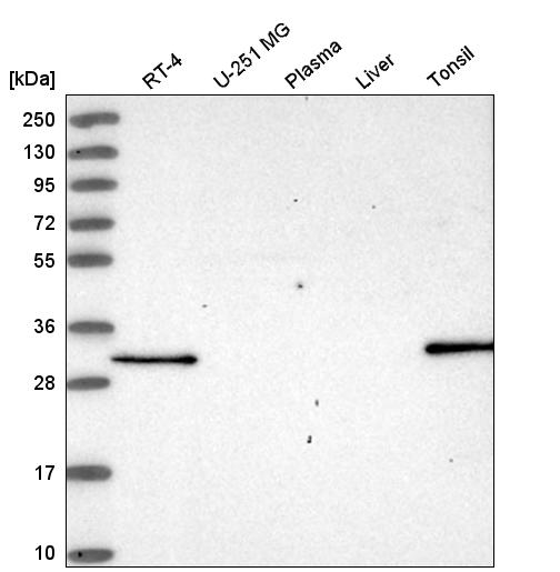 Atlas Antibodies Anti-NSMCE4A Antibody