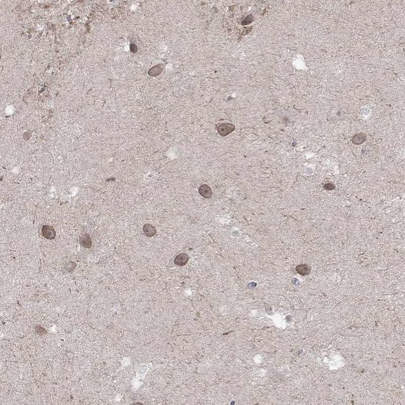Atlas Antibodies Anti-NSMF Antibody