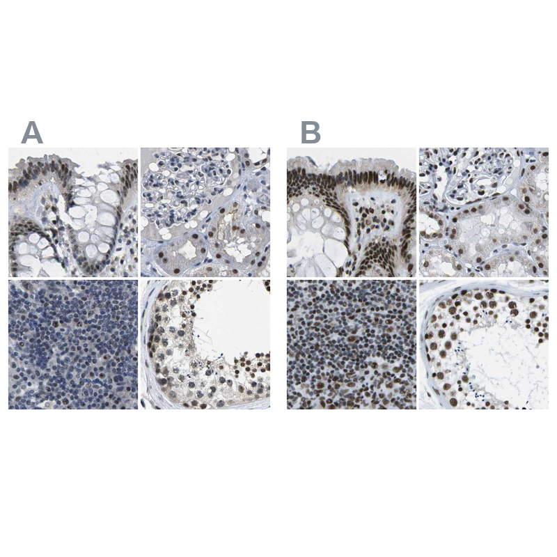 Atlas Antibodies Anti-NSRP1 Antibody