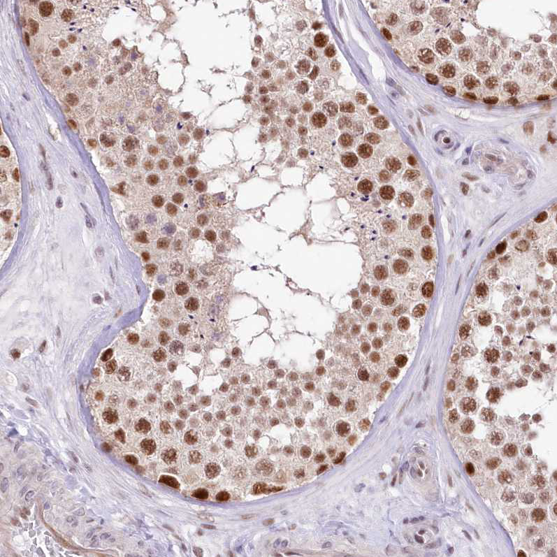 Atlas Antibodies Anti-NSUN2 Antibody