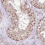Atlas Antibodies Anti-NSUN2 Antibody