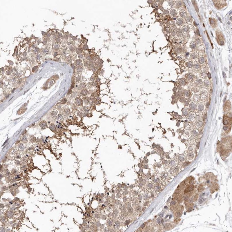 Atlas Antibodies Anti-NSUN4 Antibody