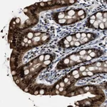 Atlas Antibodies Anti-NSUN5 Antibody