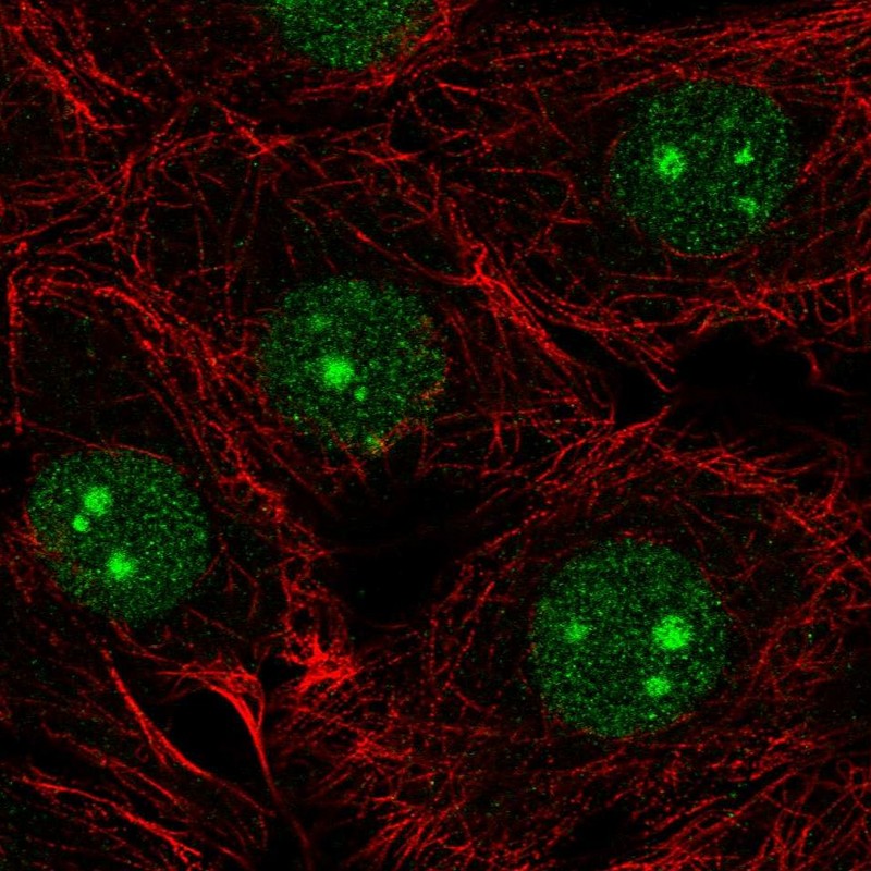 Atlas Antibodies Anti-NSUN5 Antibody