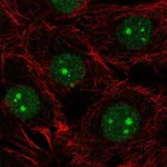 Atlas Antibodies Anti-NSUN5 Antibody