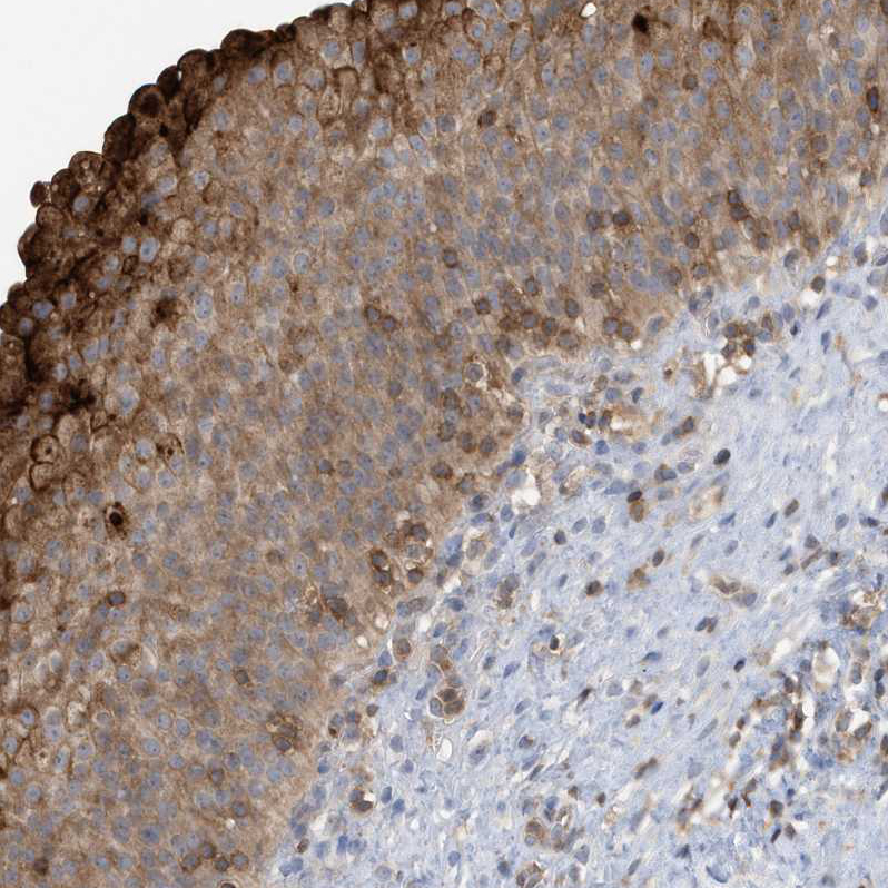 Atlas Antibodies Anti-NSUN3 Antibody