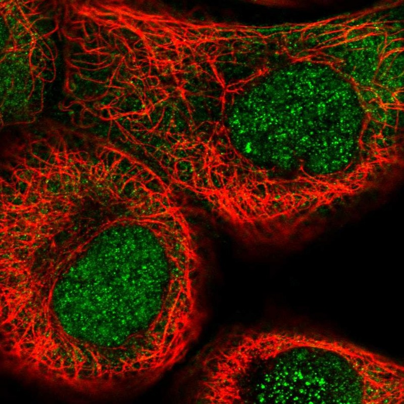 Atlas Antibodies Anti-NSUN5 Antibody