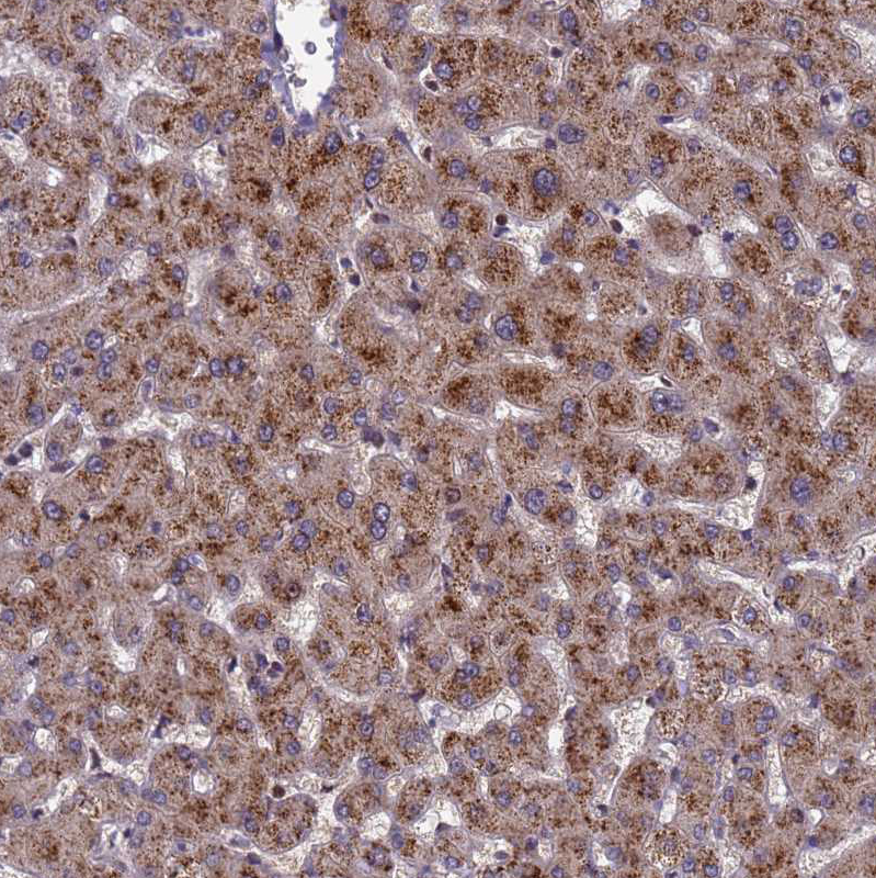 Atlas Antibodies Anti-NSUN6 Antibody
