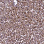 Atlas Antibodies Anti-NSUN6 Antibody