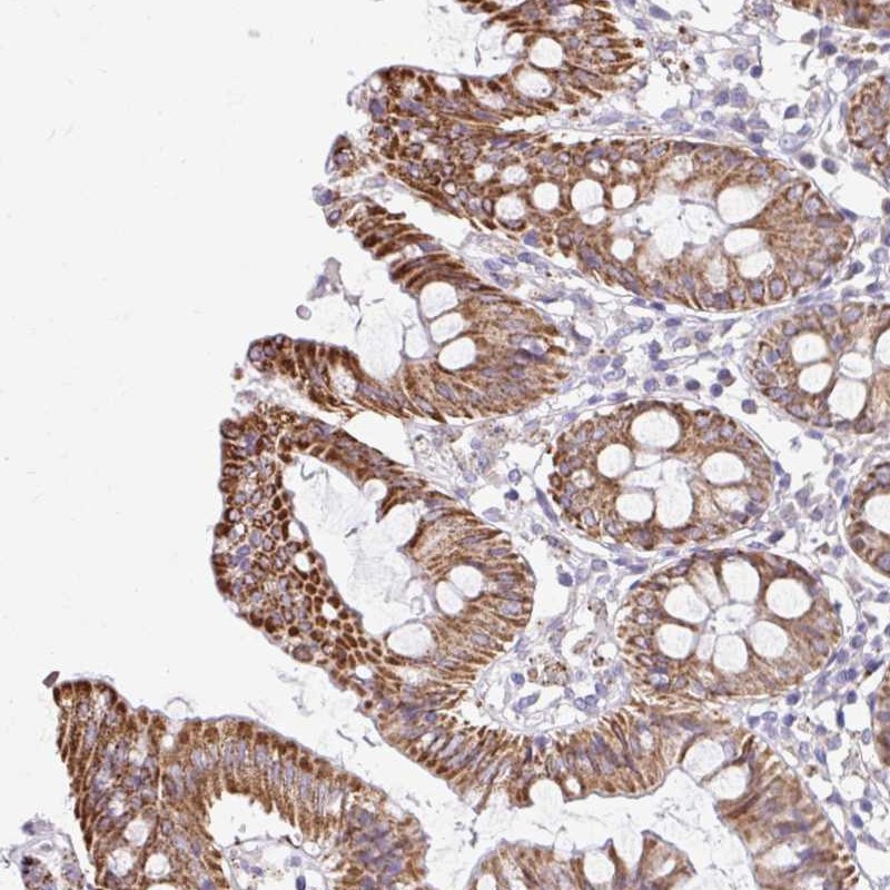 Atlas Antibodies Anti-NT5C1B Antibody