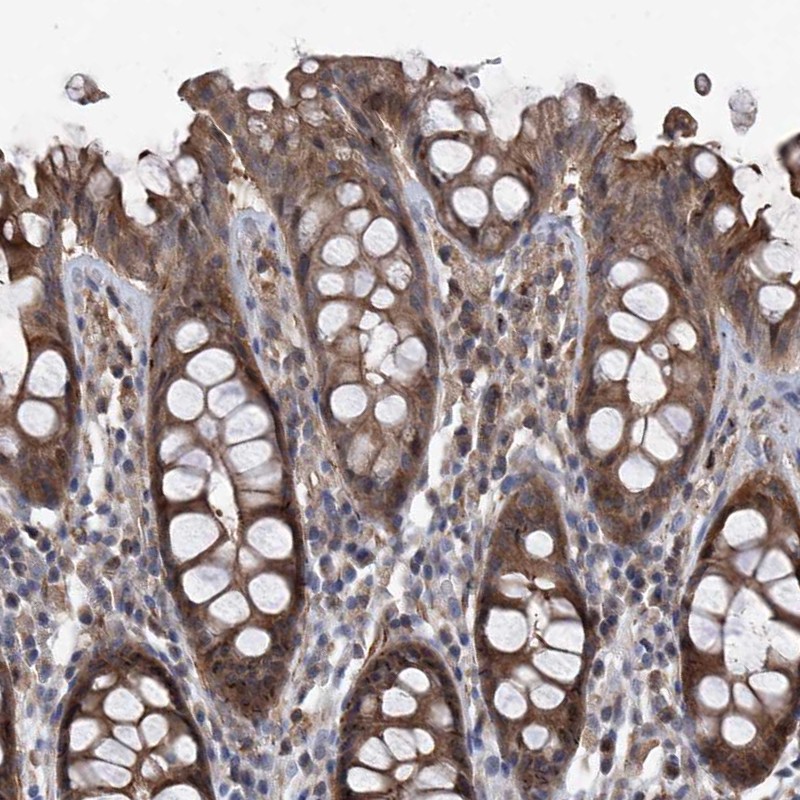 Atlas Antibodies Anti-NT5C3A Antibody