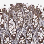 Atlas Antibodies Anti-NT5C3A Antibody