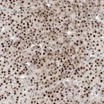 Atlas Antibodies Anti-NT5C3B Antibody