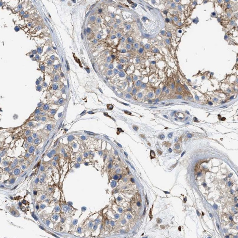 Atlas Antibodies Anti-NSUN7 Antibody