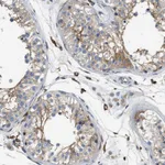 Atlas Antibodies Anti-NSUN7 Antibody