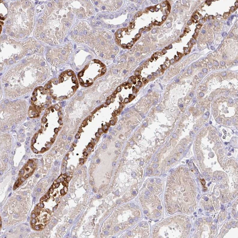 Atlas Antibodies Anti-NT5C1A Antibody