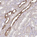 Atlas Antibodies Anti-NT5C1A Antibody