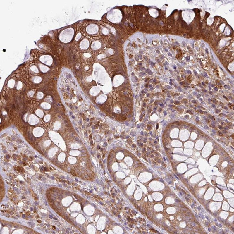 Atlas Antibodies Anti-NT5C3A Antibody