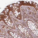 Atlas Antibodies Anti-NT5C3A Antibody