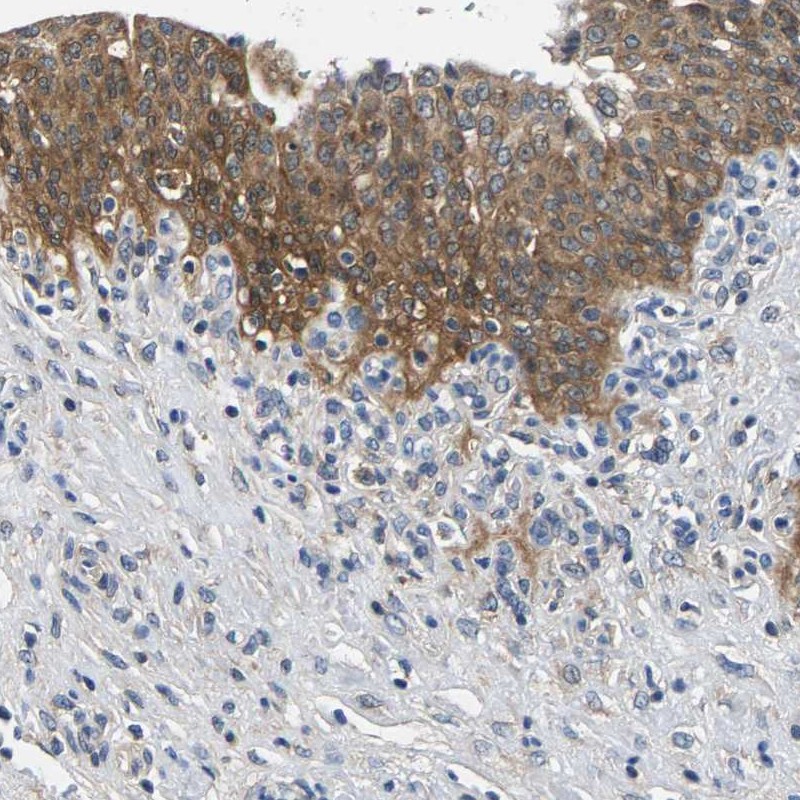 Atlas Antibodies Anti-NT5C Antibody