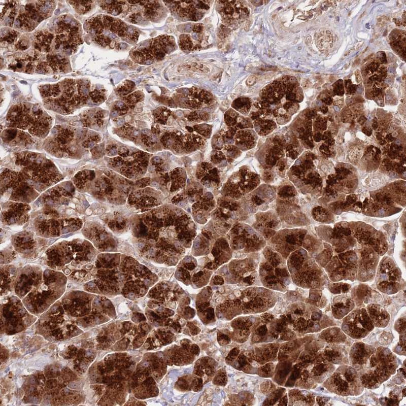 Atlas Antibodies Anti-NT5DC4 Antibody