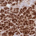 Atlas Antibodies Anti-NT5DC4 Antibody