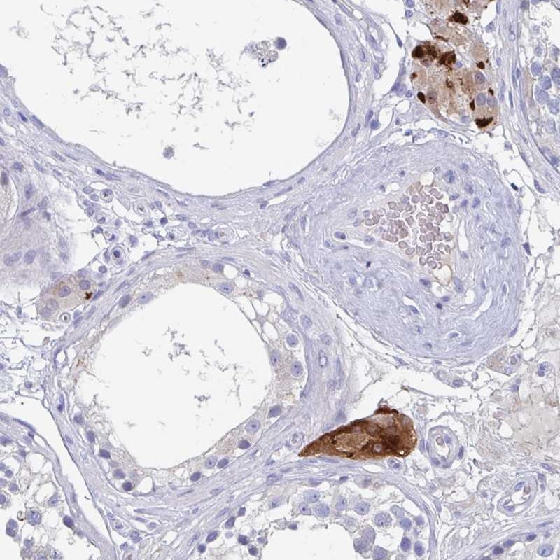 Atlas Antibodies Anti-NT5C3B Antibody