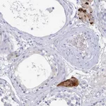 Atlas Antibodies Anti-NT5C3B Antibody