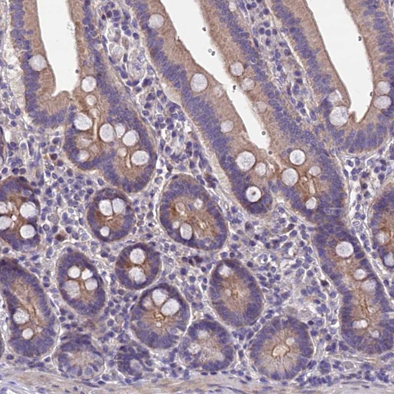 Atlas Antibodies Anti-NT5M Antibody