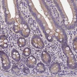 Atlas Antibodies Anti-NT5M Antibody