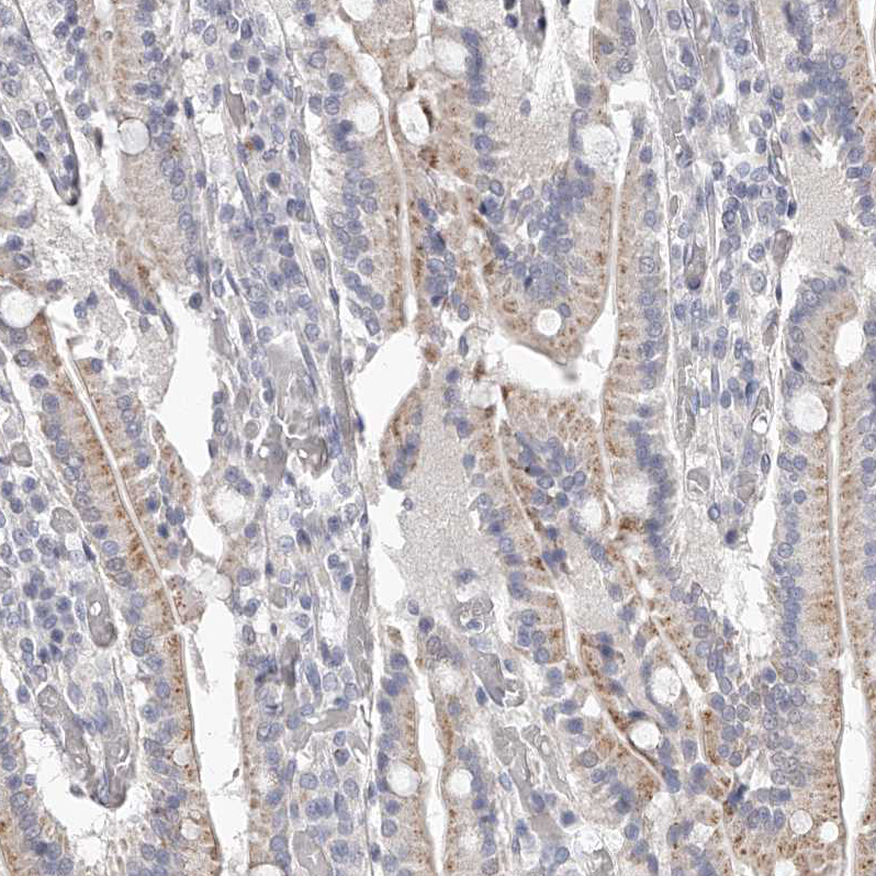 Atlas Antibodies Anti-NT5DC1 Antibody