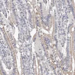 Atlas Antibodies Anti-NT5DC1 Antibody